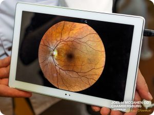 What Is Optos Retinal Imaging?