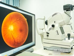 3 Eye Diseases That Can Be Detected Through Retinal Imaging