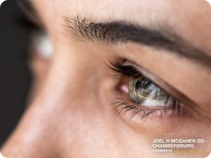 What You Should Know About Keratoconus